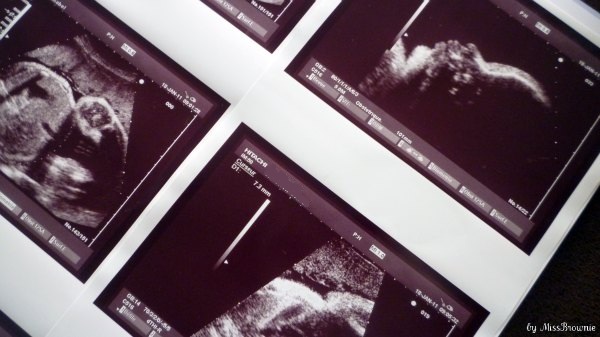 derniere-echo-3eme-trimestre